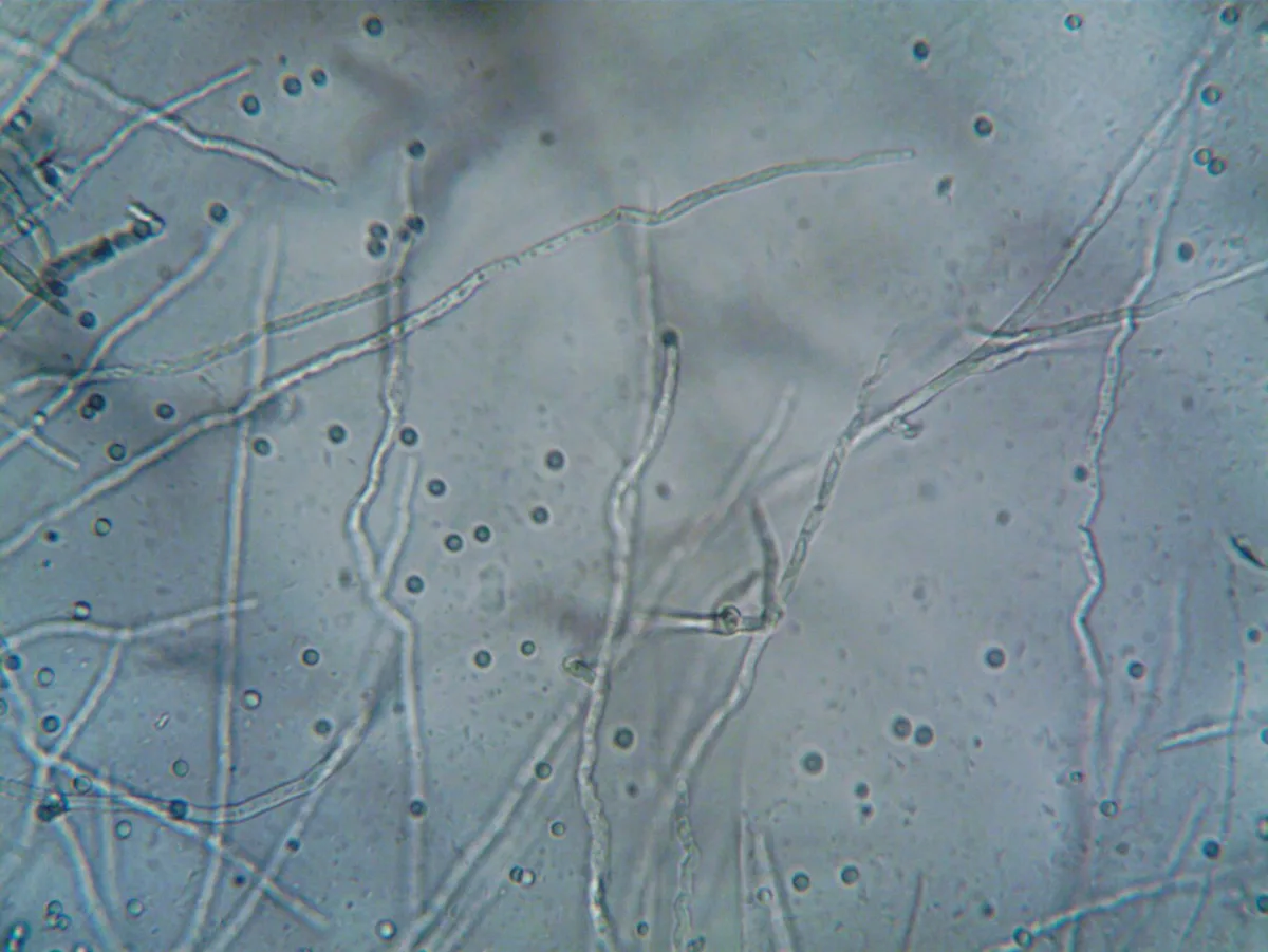 A microscope view of various airborne mold spores.
